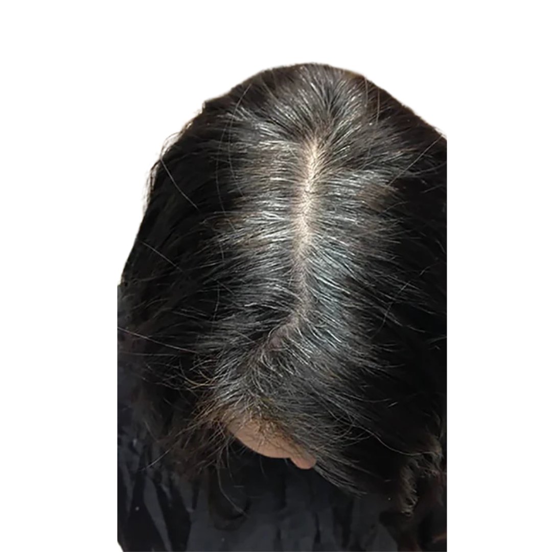 לפני: שורשים לבנים